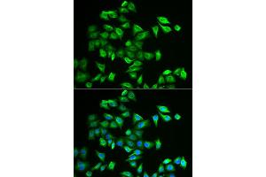 Immunofluorescence analysis of A549 cells using POMGNT2 antibody (ABIN2562968). (C3orf39 anticorps)