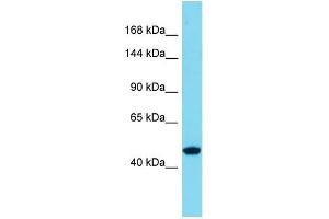 Host:  Rabbit  Target Name:  SLC39A10  Sample Type:  Thyroid Tumor lysates  Antibody Dilution:  1. (SLC39A10 anticorps  (N-Term))