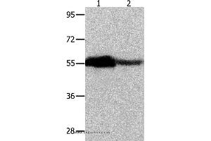 Western blot analysis of Human ovarian cancer and mouse heart tissue, using CBX2 Polyclonal Antibody at dilution of 1:350 (CBX2 anticorps)