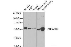 Western blot analysis of extracts of various cell lines using ATP6V1B1 Polyclonal Antibody at dilution of 1:1000. (ATP6V1B1 anticorps)