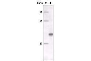Western Blot showing MER antibody used against full-length MER recombinant protein.