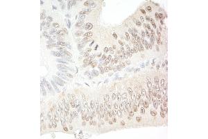 anti-Chromosome 1 Open Reading Frame 55 (C1orf55) (AA 350-400) antibody