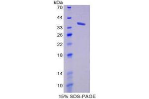 SDS-PAGE (SDS) image for Induced Myeloid Leukemia Cell Differentiation Protein Mcl-1 (MCL1) (AA 2-307) protein (His tag) (ABIN2125983)