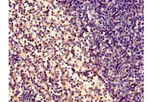 Immunohistochemistry of paraffin-embedded human spleen tissue using ABIN7160145 at dilution of 1:100 (ABHD2 anticorps  (AA 31-320))