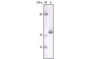 Western blot analysis using DDR2 mouse mAb against truncated DDR2 recombinant protein. (DDR2 anticorps)
