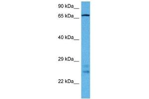 Host:  Rabbit  Target Name:  DLL1  Sample Tissue:  Rat Brain  Antibody Dilution:  1ug/ml