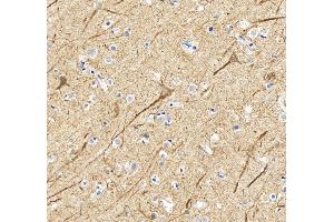 IHC analysis of NF-L/NEFL using anti-NF-L/NEFL antibody (ABIN7601626).