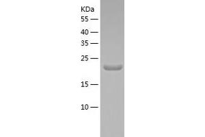 Western Blotting (WB) image for CTD (Carboxy-terminal Domain, RNA Polymerase II, Polypeptide A) Phosphatase, Subunit 1 (CTDP1) (AA 178-341) protein (His-IF2DI Tag) (ABIN7122507)