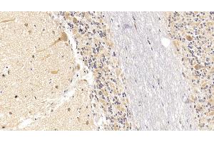 Detection of SEMA5B in Human Cerebellum Tissue using Monoclonal Antibody to Semaphorin 5B (SEMA5B)