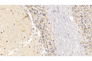 Detection of SEMA5B in Human Cerebellum Tissue using Monoclonal Antibody to Semaphorin 5B (SEMA5B) (SEMA5B anticorps  (AA 350-602))