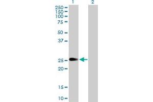 Western Blot analysis of PIP5K1C expression in transfected 293T cell line by PIP5K1C MaxPab polyclonal antibody. (PIP5K1C anticorps  (AA 1-206))