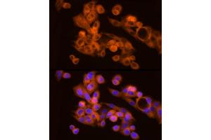 Immunofluorescence analysis of HepG2 cells using N Rabbit mAb (ABIN7268773) at dilution of 1:200 (40x lens). (NAT1 anticorps)