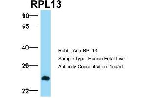 Host:  Rabbit  Target Name:  RPL13  Sample Type:  Human Fetal Liver  Antibody Dilution:  1. (RPL13 anticorps  (C-Term))