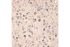 Immunohistochemistry of paraffin-embedded mouse brain using Musashi-2 (Musashi-2 (MSI2)) Rabbit mAb (ABIN7268701) at dilution of 1:100 (40x lens). (MSI2 anticorps)