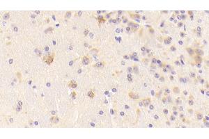 Detection of TFR in Mouse Cerebrum Tissue using Polyclonal Antibody to Transferrin Receptor (TFR)