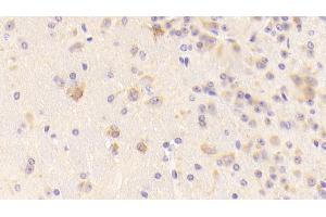 Detection of TFR in Mouse Cerebrum Tissue using Polyclonal Antibody to Transferrin Receptor (TFR) (Transferrin Receptor anticorps  (AA 572-757))