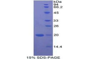 SDS-PAGE analysis of Human MFAP5 Protein. (MFAP5 Protéine)