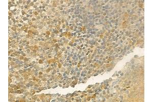 ABIN6257284 and ABIN6274172 at 1/100 staining human normal tonsil tissue by IHC-P. (IRF2 anticorps  (Internal Region))