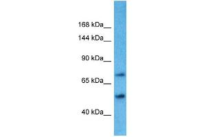 Host: Rabbit Target Name: TBC1D8B Sample Type: Placenta lysates Antibody Dilution: 1. (TBC1D8B anticorps  (N-Term))