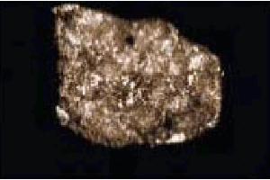 Immunofluorescence staining of HeLa cells (Human cervical epitheloid carcinoma, ATCC CCL-2.