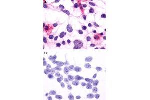 Immunocytochemistry (ICC) staining of HEK293 human embryonic kidney cells transfected (A) or untransfected (B) with RHO. (Rho-related GTP-binding protein anticorps  (2nd Extracellular Domain))