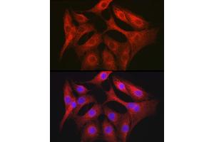 Immunofluorescence analysis of NIH/3T3 cells using OL Rabbit pAb (1671) at dilution of 1:150 (40x lens). (OLA1 anticorps  (AA 297-396))
