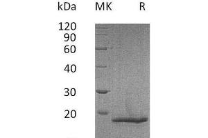 Western Blotting (WB) image for Collagen, Type XVIII, alpha 1 (COL18A1) protein (His tag) (ABIN7320492) (COL18A1 Protein (His tag))
