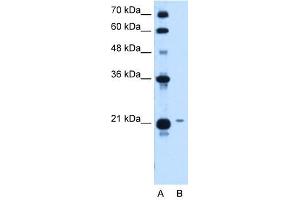 TCP10L antibody used at 1. (TCP10L anticorps)
