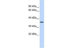 WB Suggested Anti-ZNF124 Antibody Titration:  0. (ZNF124 anticorps  (Middle Region))
