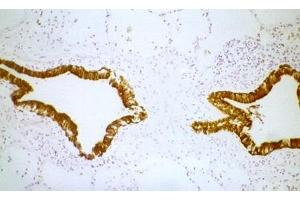 anti-Keratin 5/8 (KRT5/8) antibody