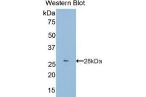 WB of Protein Standard: different control antibodies against Highly purified E. (Granulin Kit CLIA)