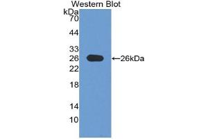 Western blot analysis of the recombinant protein. (Interleukin enhancer-binding factor 3 (ILF3) (AA 672-891) anticorps)