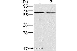 Western blot analysis of Mouse liver and lung tissue, using PTGER2 Polyclonal Antibody at dilution of 1:200 (PTGER2 anticorps)