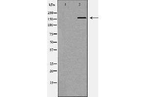 Western blot analysis of Hepg2 whole cell lysates, using SMARCA4 Antibody.