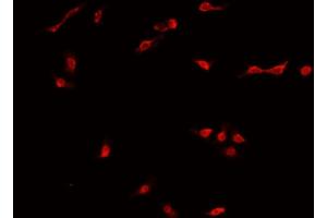 ABIN6269035 staining MCF-7 cells by IF/ICC. (DNMT3B anticorps  (N-Term))