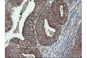 Image no. 2 for anti-Cytochrome C Oxidase Subunit VIc (COX6C) antibody (ABIN1497586)