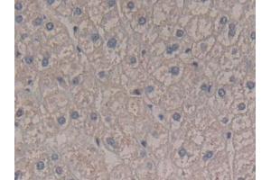 DAB staining on IHC-P; Samples: Human Liver Tissue (Interferon gamma anticorps  (AA 24-166))