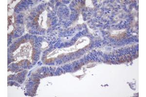 Image no. 1 for anti-Cytochrome P450, Family 2, Subfamily J, Polypeptide 2 (CYP2J2) antibody (ABIN1497733)