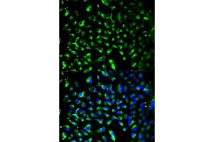 Immunofluorescence analysis of HeLa cells using PHB antibody.