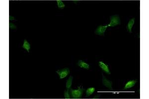 Immunofluorescence of monoclonal antibody to IL1A on HeLa cell. (IL1A anticorps  (AA 172-271))