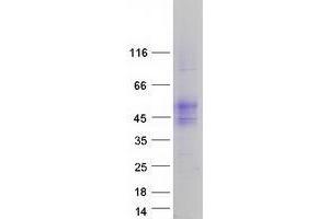Validation with Western Blot (TMIGD2 Protein (Transcript Variant 2) (Myc-DYKDDDDK Tag))