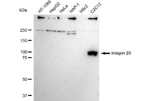 Western blotting analysis using Integrin β3 antibody (ABIN7799070). (Recombinant Integrin beta 3 anticorps)