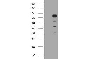 Image no. 1 for anti-Myotubularin Related Protein 2 (MTMR2) antibody (ABIN1499592) (MTMR2 anticorps)