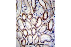 BCAT2 Antibody (C-term) immunohistochemistry analysis in formalin fixed and paraffin embedded human kidney tissue followed by peroxidase conjugation of the secondary antibody and DAB staining.