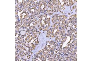IHC analysis of TOM1L1 using anti-TOM1L1 antibody (ABIN7602631). (TOM1L1 anticorps  (AA 9-448))