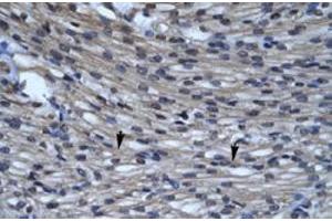Immunohistochemical staining (Formalin-fixed paraffin-embedded sections) of human heart with CLIC5 polyclonal antibody  at 4-8 ug/mL working concentration. (CLIC5 anticorps  (C-Term))