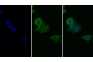 Detection of PAI1 in Human Hela cell using Monoclonal Antibody to Plasminogen Activator Inhibitor 1 (PAI1) (PAI1 anticorps)