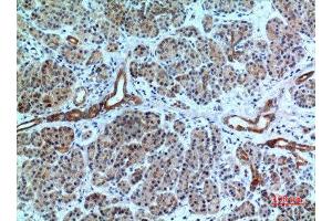 Immunohistochemistry (IHC) analysis of paraffin-embedded Human Pancreas, antibody was diluted at 1:100. (CXCR6 anticorps  (N-Term))
