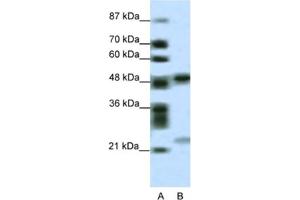 Western Blotting (WB) image for anti-PHD Finger Protein 11 (PHF11) antibody (ABIN2461063) (PHF11 anticorps)