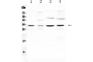 Western blot analysis of Aquaporin 3 using anti- Aquaporin 3 antibody .
